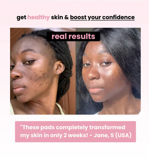 Turmeric Kojic Cleansing Pads